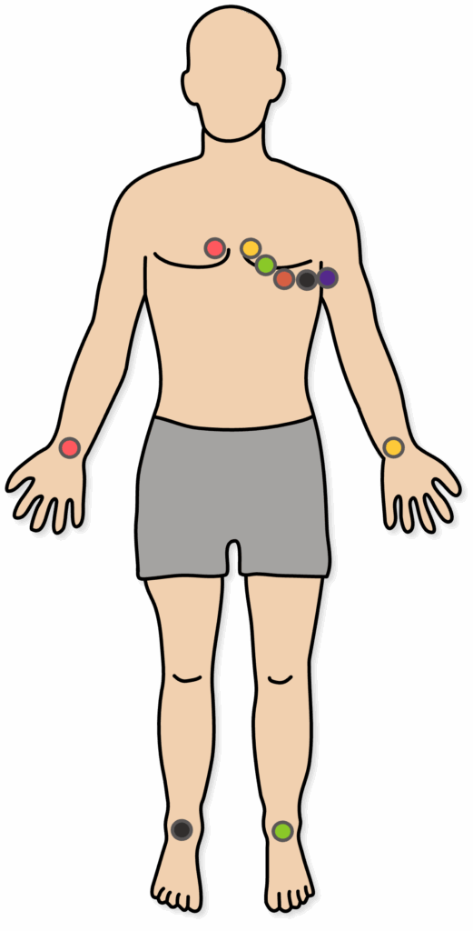 EKG Elektroden Position