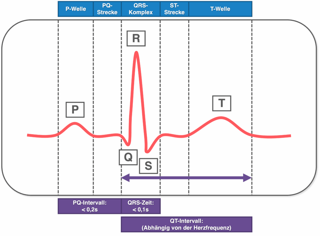 EKG Wellen - Überblick