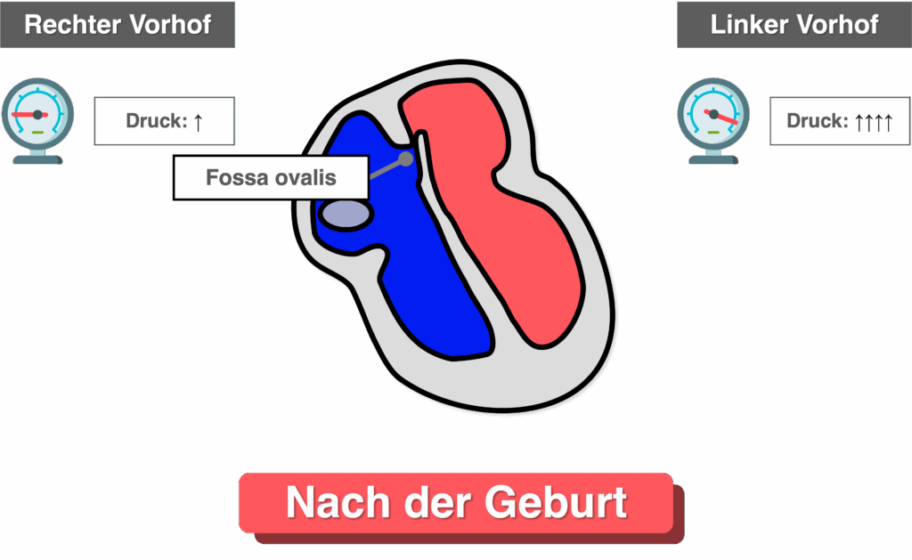 Fossa ovalis Bildung