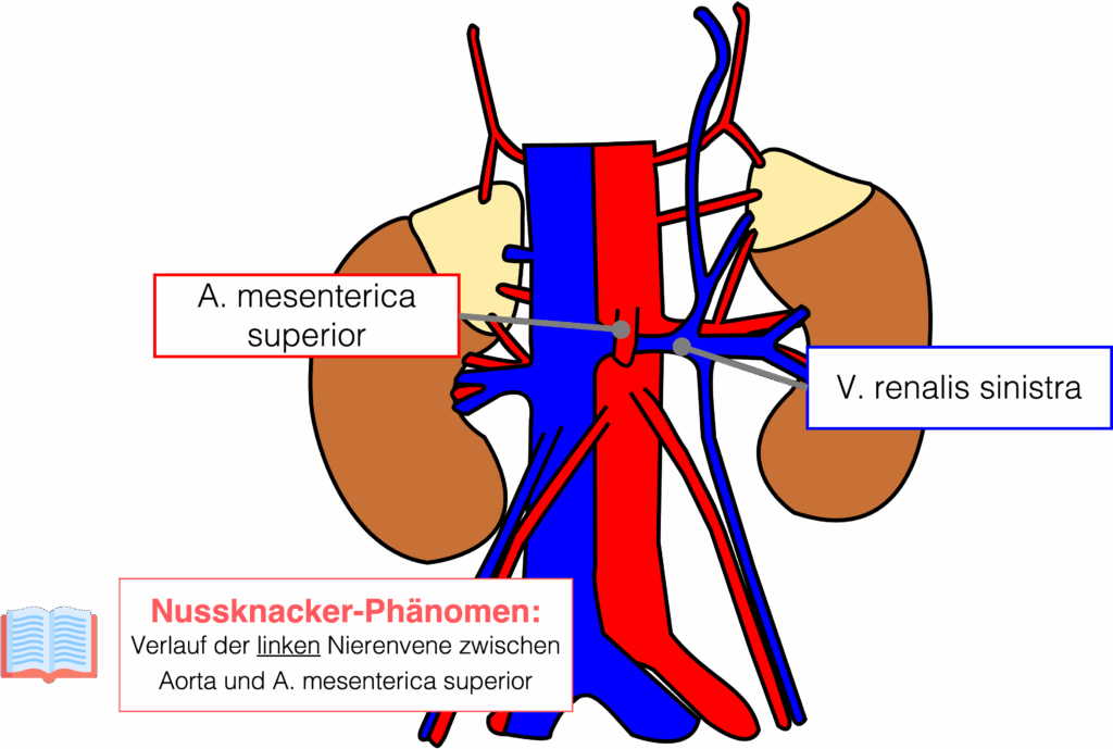 Nussknacker Phänomen