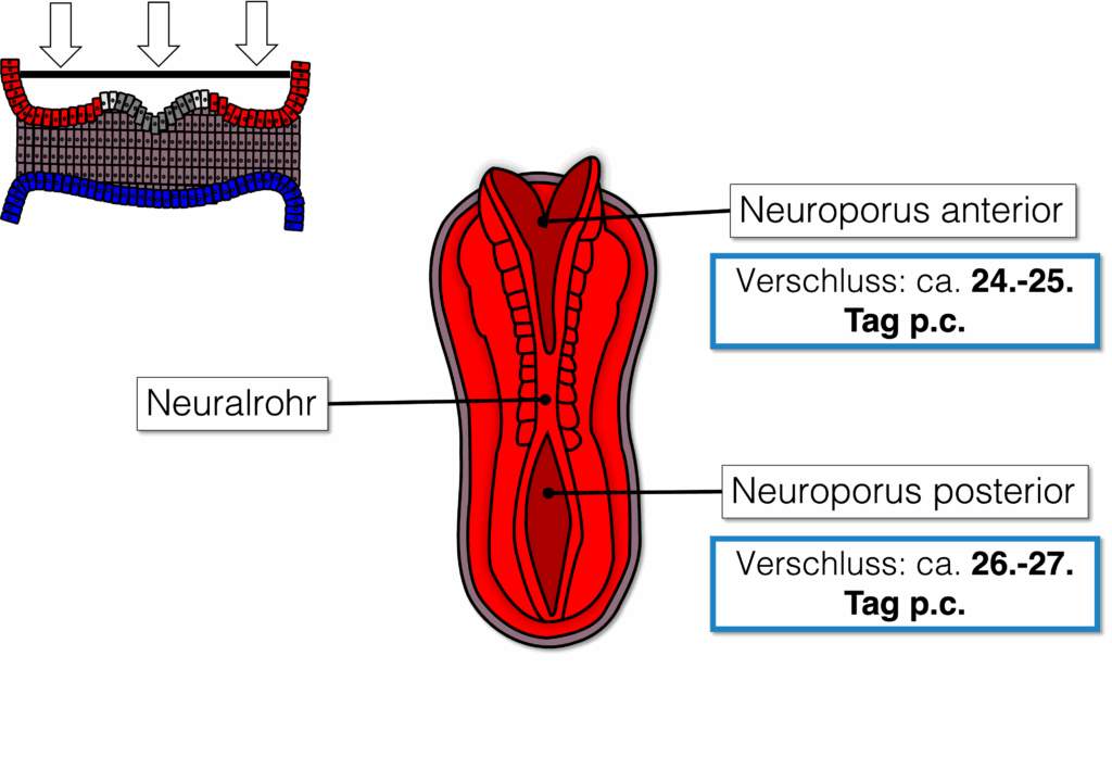 Verschluss des Neuralrohr