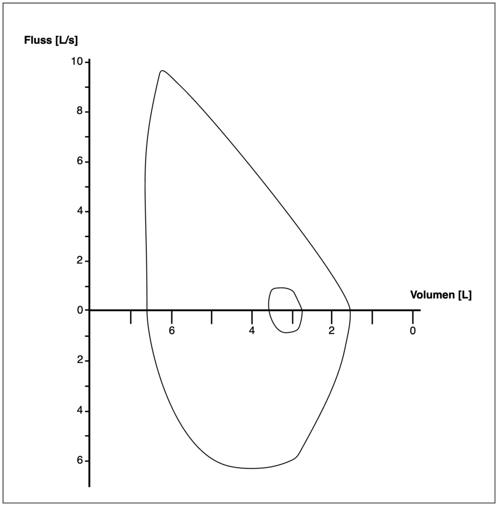 Beispiel Fluss Volumen Kurve
