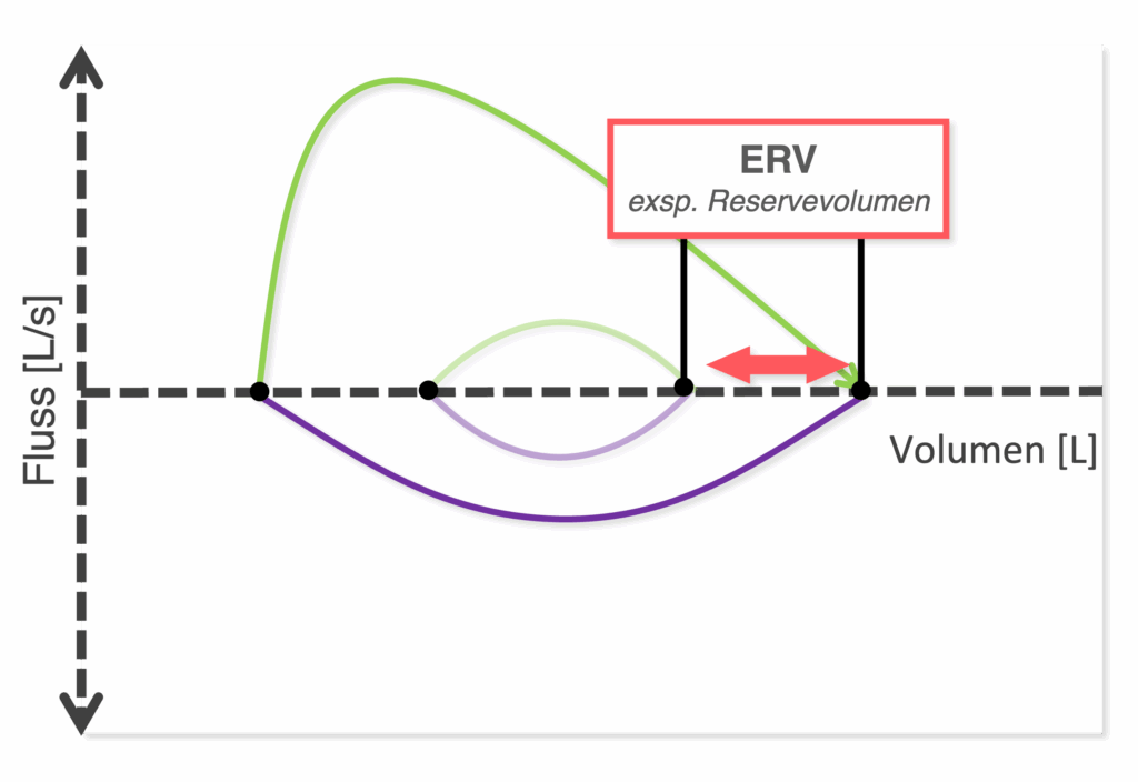 Fluss-Volumen-Kurve Schema - Exspiratorisches Reservevolumen (ERV)