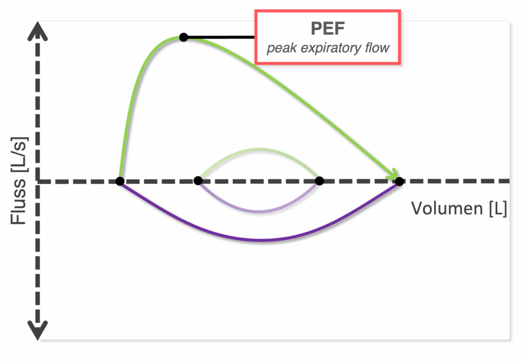 Fluss-Volumen-Kurve Schema - PEF