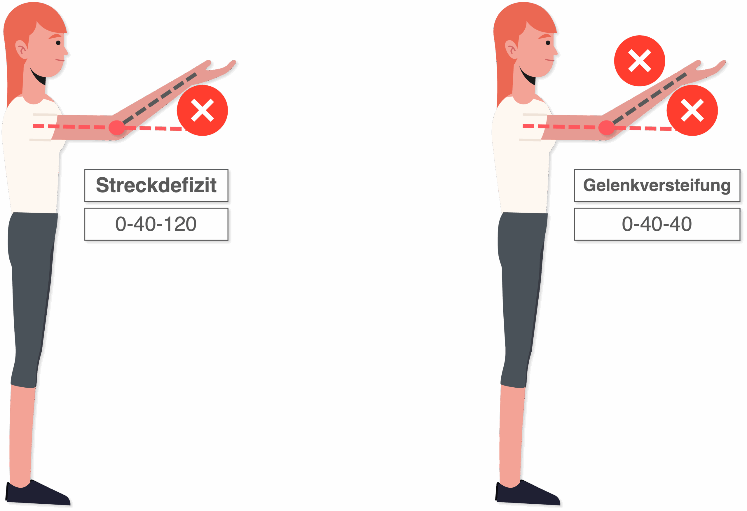 Neutral-Null-Methode - Sonderfälle