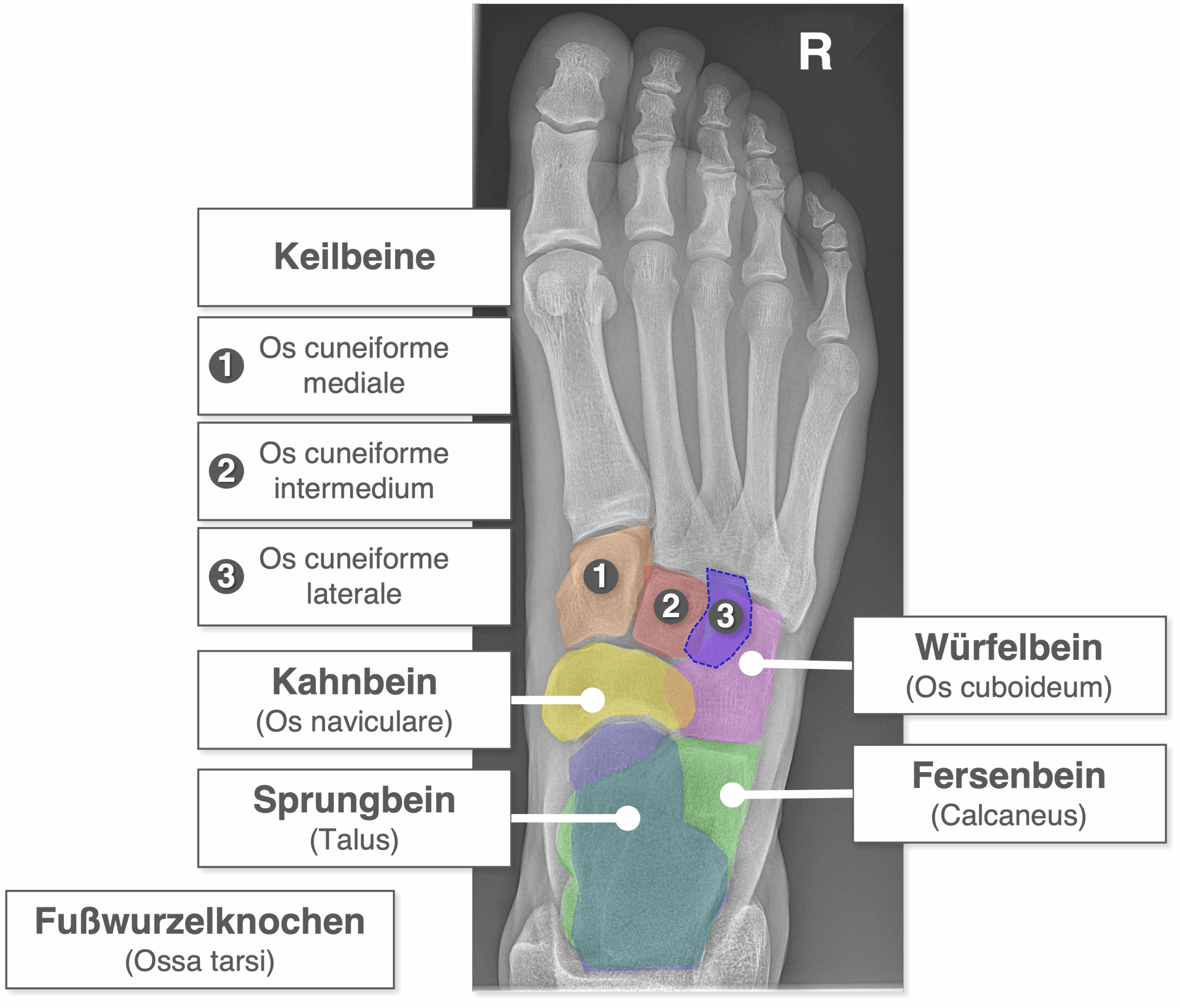 Fuß Röntgenbild - Fußwurzel