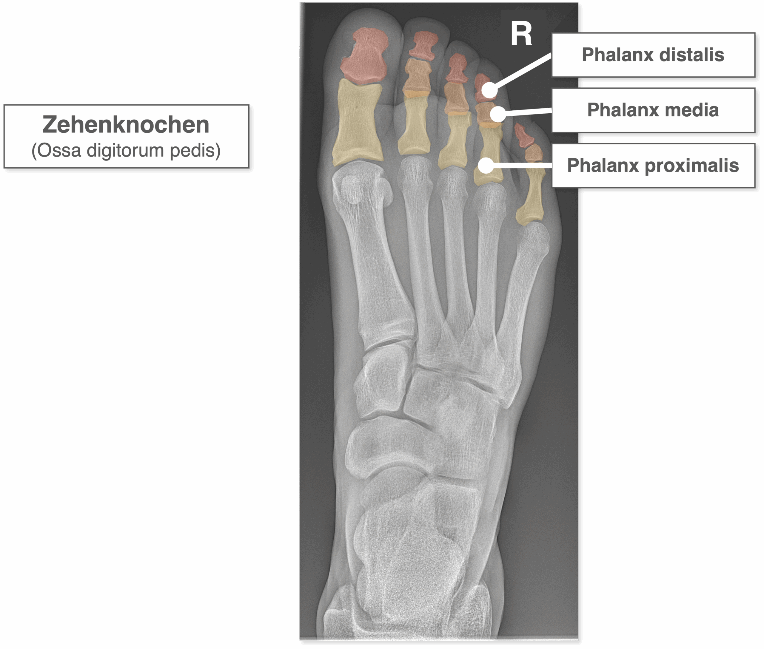 Fuß Röntgenbild - Zehenknochen