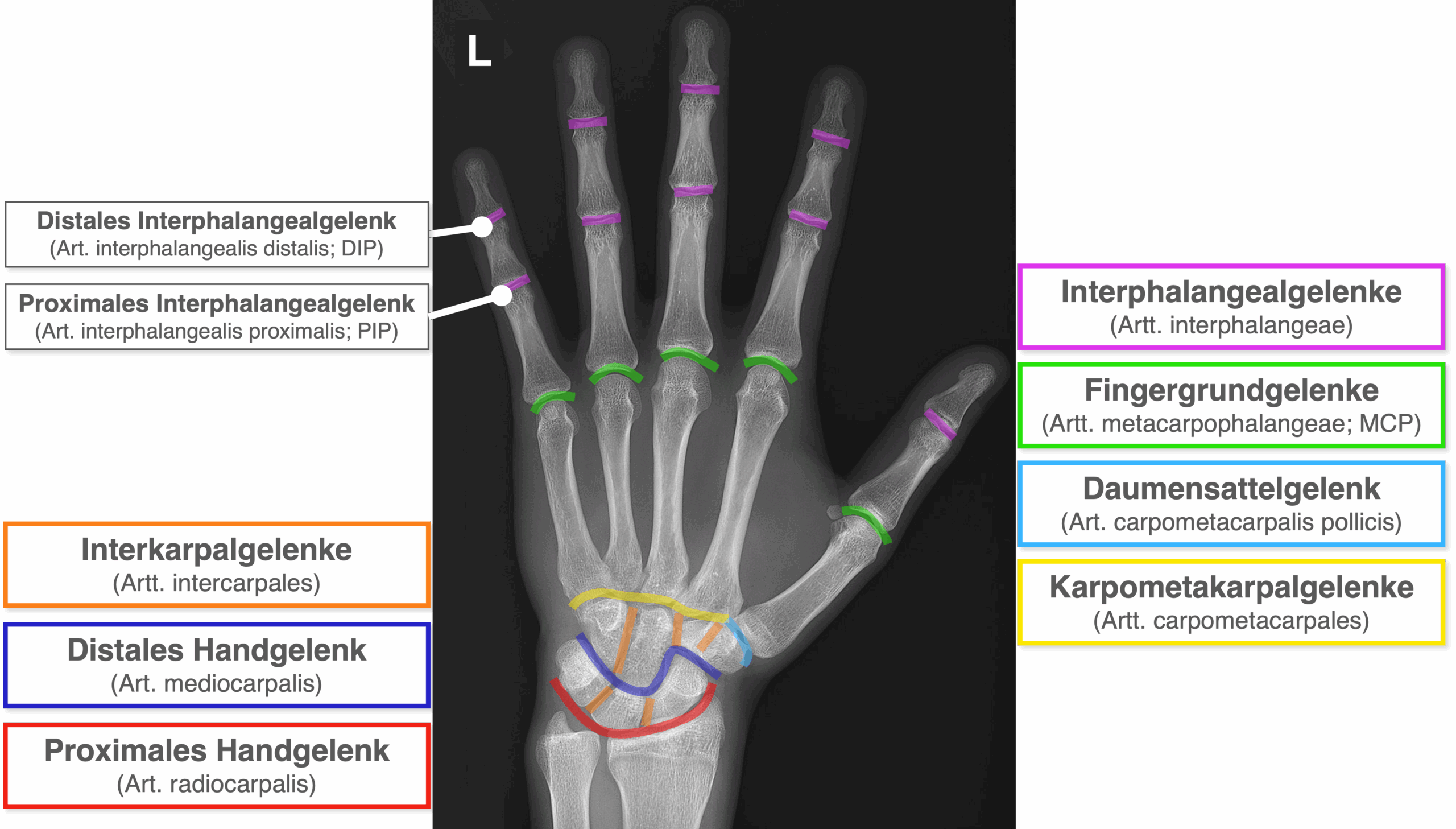 Hand Röntgenbild - Gelenke Übersicht