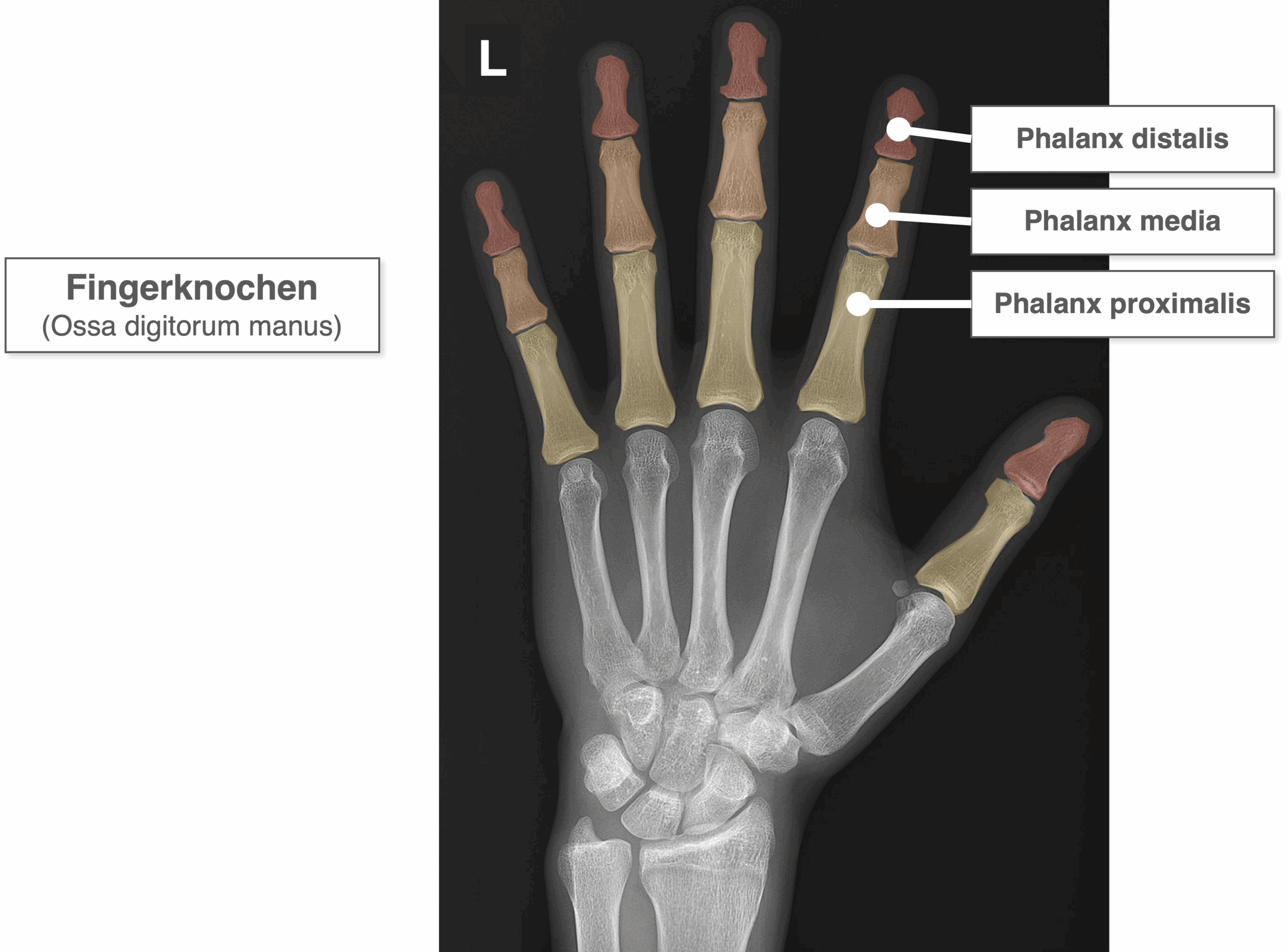 Hand Röntgenbild - Fingerknochen