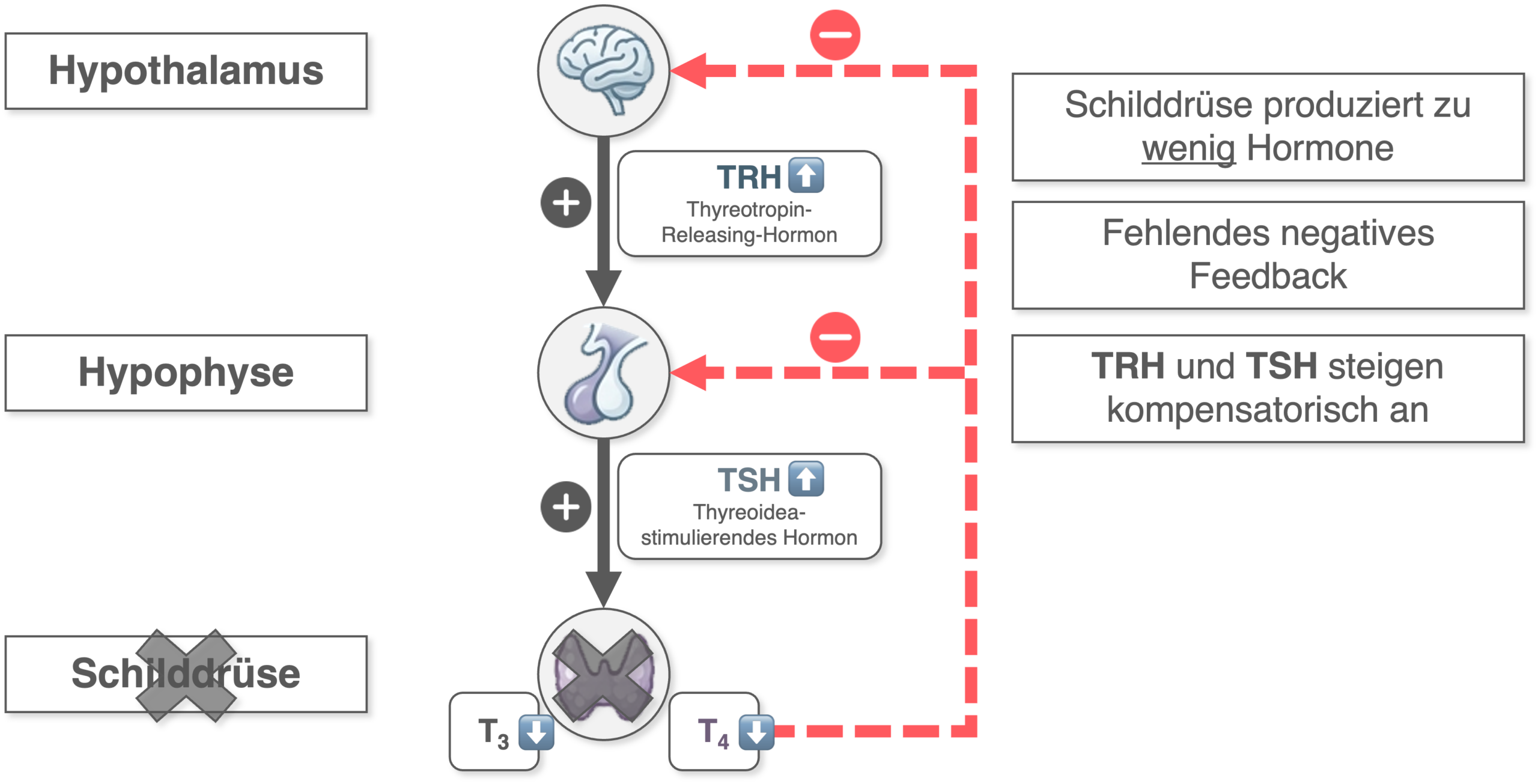 Primäre Hypothyreose - Pathogenese